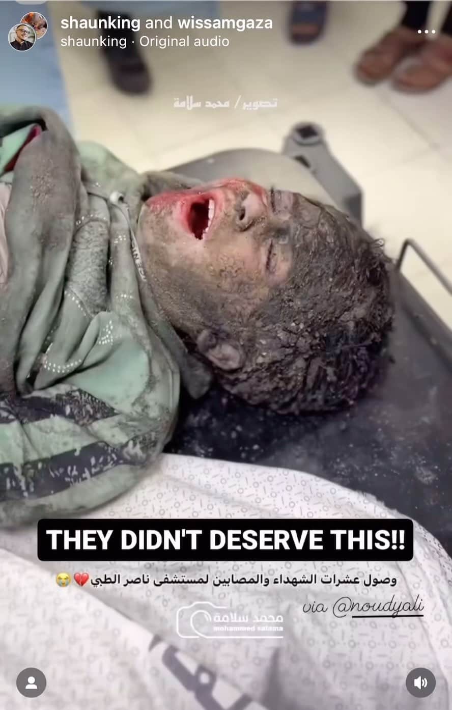 カリム・レキクのインスタグラム：「Listen to the pain from broken bones and skin burned away by Israeli and United States bombs..💔🇵🇸」