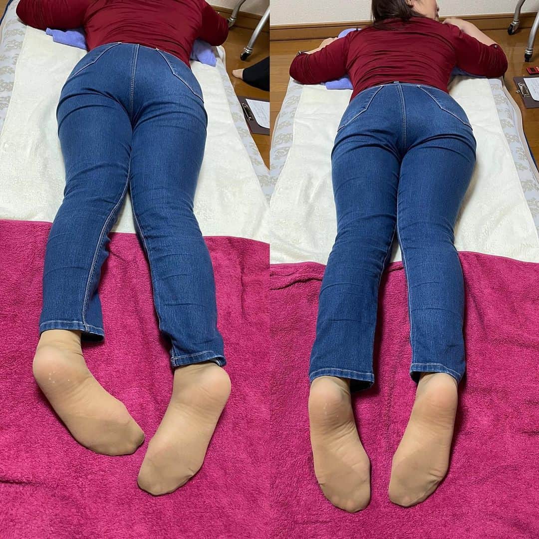 のインスタグラム：「昨日のお客様🧡  右脚から骨盤矯正　更にヒップアップ矯正をし！両方整えて 脚が3センチも伸びました！🥰  #楽しんごサロンぼくんち   ご予約はこちらにdmください！」