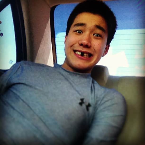 大森勝太朗のインスタグラム：「Tough day at training... Knocked a tooth out today 😢 🔨 #milktea #boba #bored #yankeedoodle #banjo #missingtooth #longcarrides with @angel2axel」