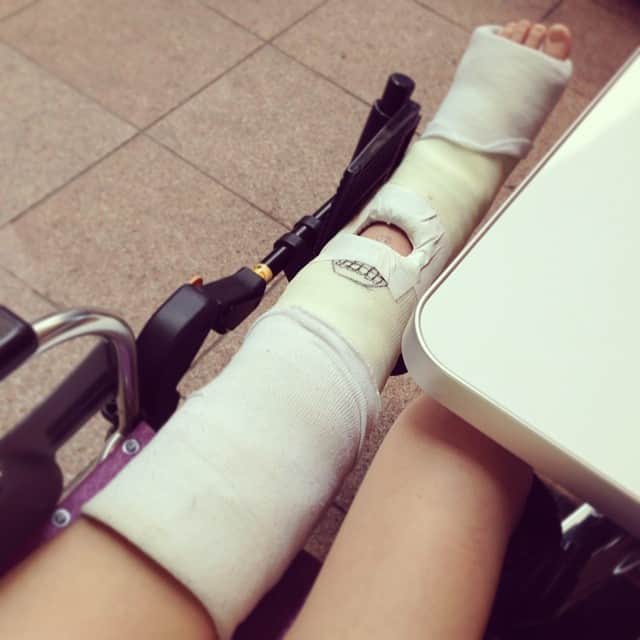 安藤成子さんのインスタグラム写真 - (安藤成子Instagram)「最近骨折してたところがずっと痛いです。  気圧の関係？！運動しすぎ？！ もう完治して半年以上経つのに…💦」6月26日 12時54分 - seikoando